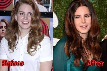 A before and after picture of Lana Del Rey.